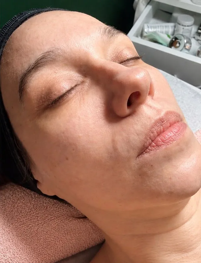 Fața după tratamentul facial clasic