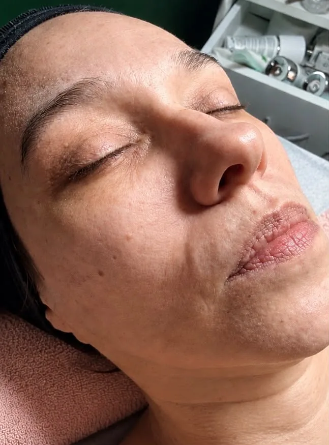 Fața înainte de tratamentul facial clasic